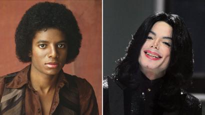 Autopsy: Michael Jackson was completely bald, had strange tattoos