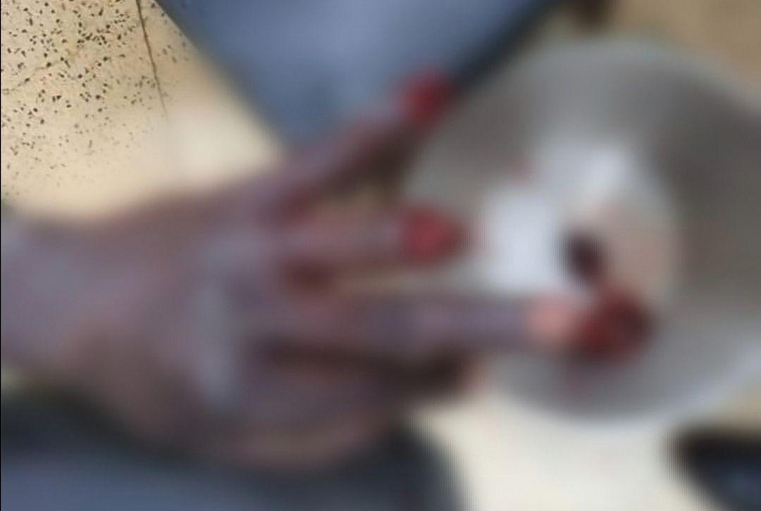 Disturbing Pictures: Police Shoot and Injure Kabarnet Residents
