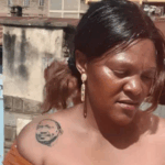 Shock as Woman With President Ruto Tattoo Suffers Horrific Attack in Nairobi